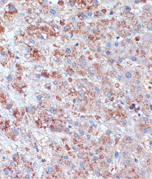 TCIRG1 Polyclonal Antibody