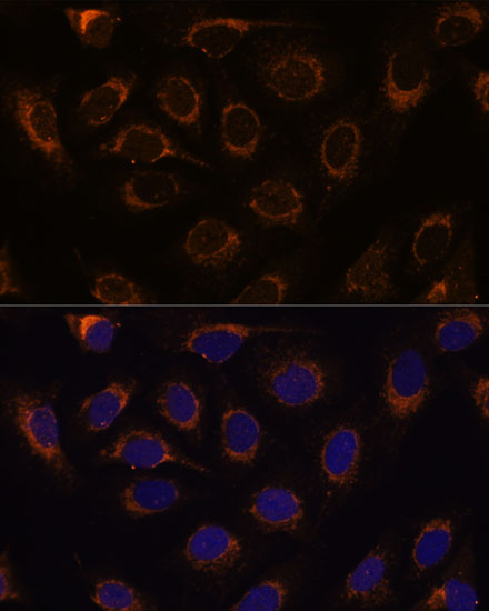 TCIRG1 Polyclonal Antibody
