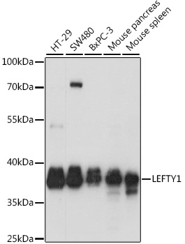 LEFTY1 Polyclonal Antibody