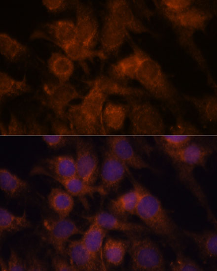 SEC23IP Polyclonal Antibody