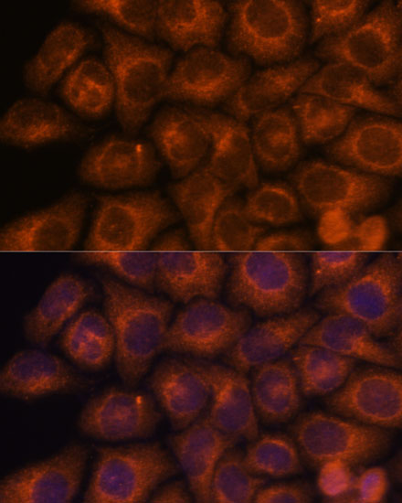 SEC23IP Polyclonal Antibody