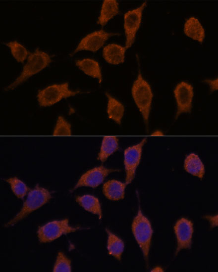SEC23IP Polyclonal Antibody