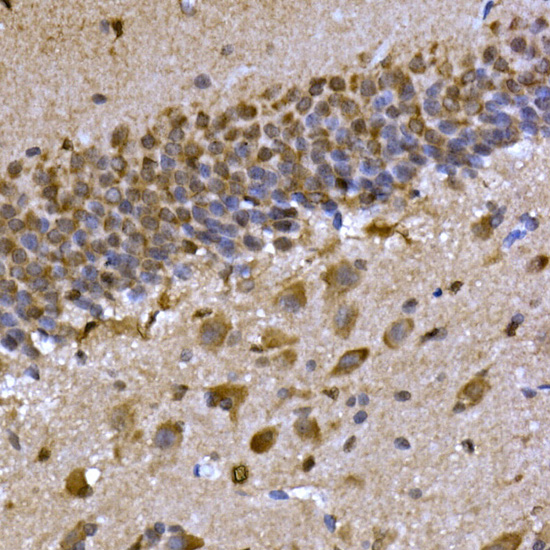 CPEB3 Polyclonal Antibody