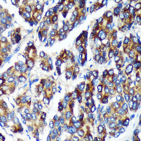 PLEKHB2 Polyclonal Antibody