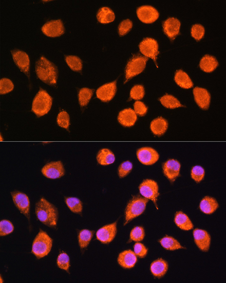 SMPD4 Polyclonal Antibody