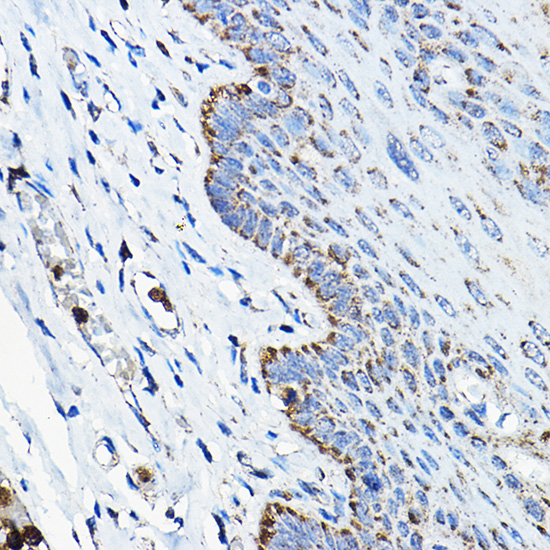 OGDHL Polyclonal Antibody
