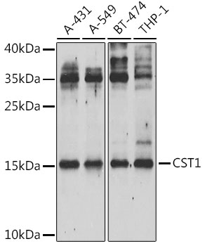 CST1 Rabbit Polyclonal Antibody