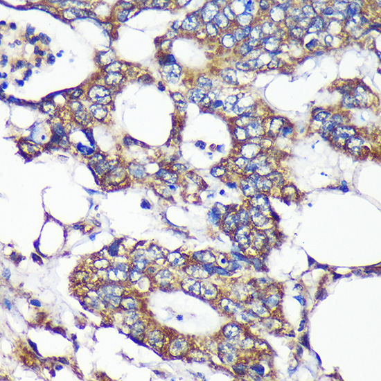 SLIRP Polyclonal Antibody
