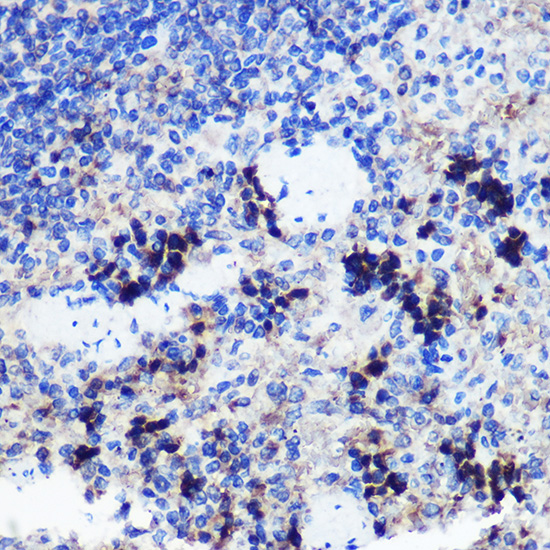 FCHSD1 Polyclonal Antibody