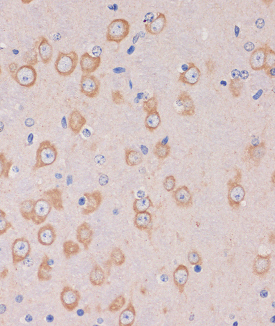 TRAPPC6B Polyclonal Antibody