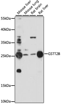 GSTT2B Polyclonal Antibody