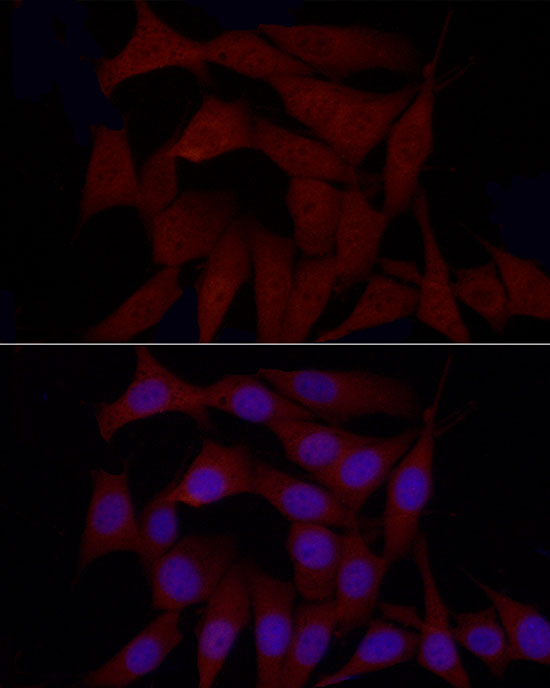 SREBF1 Polyclonal Antibody