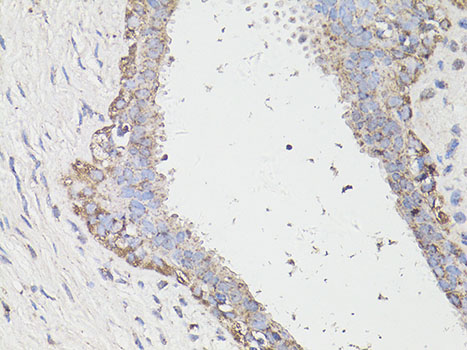 LC3A / LC3B Polyclonal Antibody