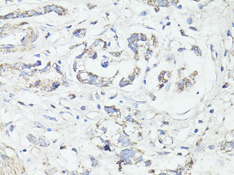 LC3A / LC3B Polyclonal Antibody