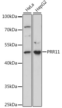 PRR11 Polyclonal Antibody