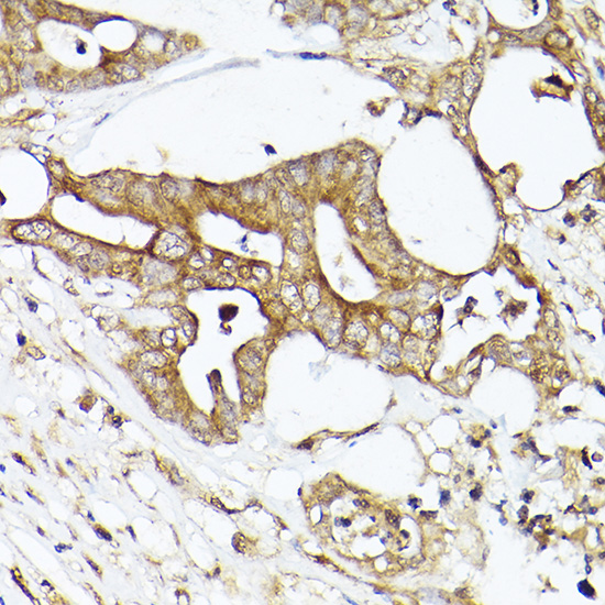 ACACA Polyclonal Antibody