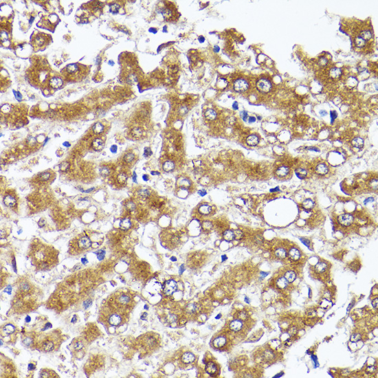 ACACA Polyclonal Antibody