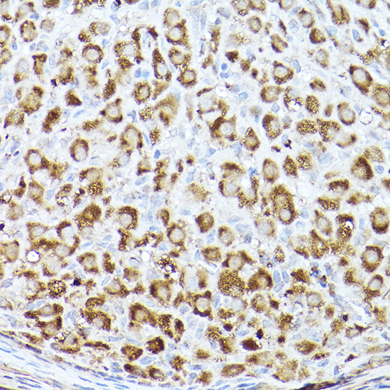 ACACA Polyclonal Antibody
