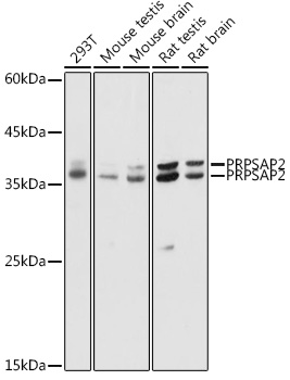 PRPSAP2 Polyclonal Antibody