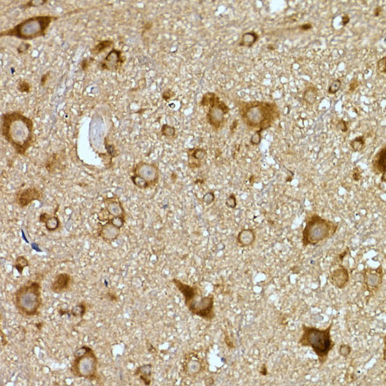 PRPSAP2 Polyclonal Antibody