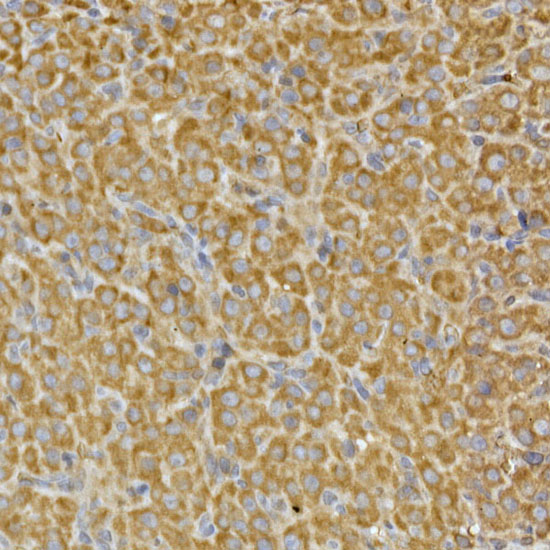 PRPSAP2 Polyclonal Antibody