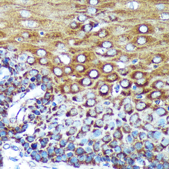 SPECC1L Polyclonal Antibody