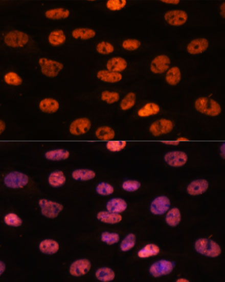 MYEF2 Polyclonal Antibody