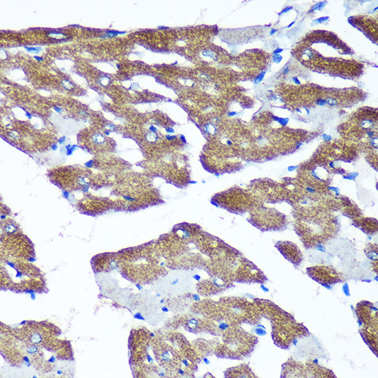 TIMMDC1 Polyclonal Antibody