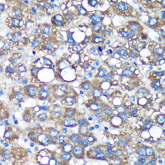 TIMMDC1 Polyclonal Antibody