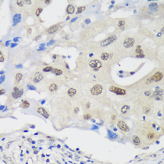 UCKL1 Polyclonal Antibody