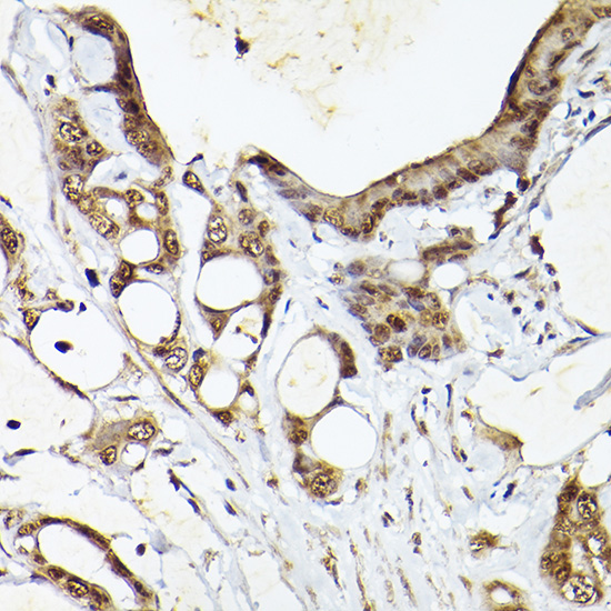 UBQLN4 Polyclonal Antibody