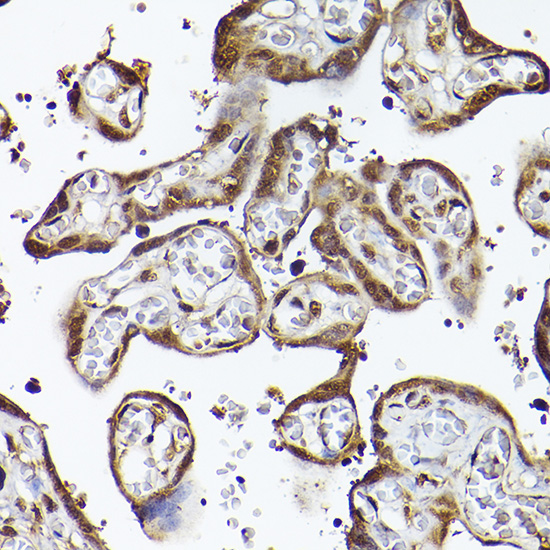 UBQLN4 Polyclonal Antibody