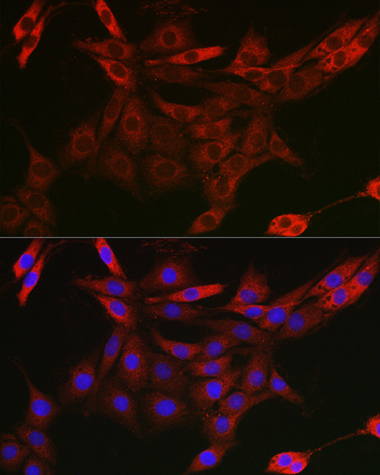 UBQLN4 Polyclonal Antibody