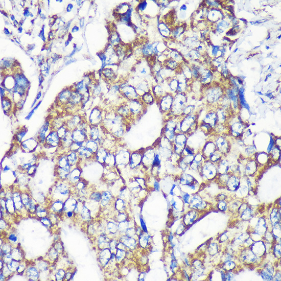 MRPS35 Polyclonal Antibody