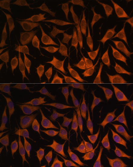 MRPS35 Polyclonal Antibody