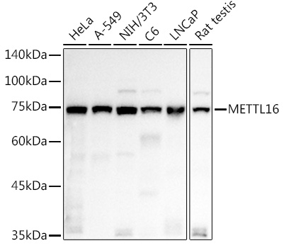METTL16 Polyclonal Antibody