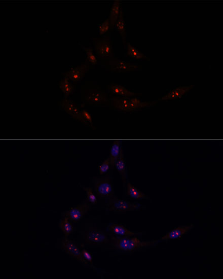 METTL16 Polyclonal Antibody