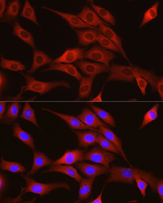 TRIM4 Polyclonal Antibody