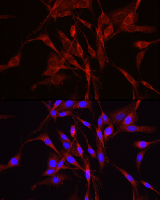 TRIM4 Polyclonal Antibody