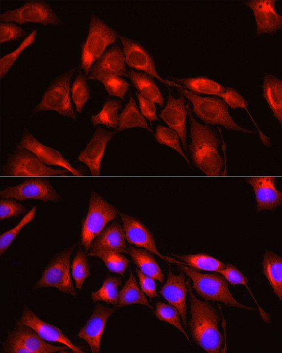 TRIM4 Polyclonal Antibody