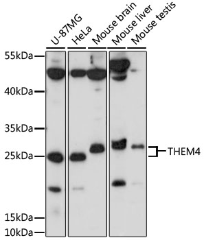 THEM4 Polyclonal Antibody