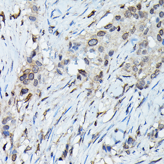 C9orf72 Polyclonal Antibody
