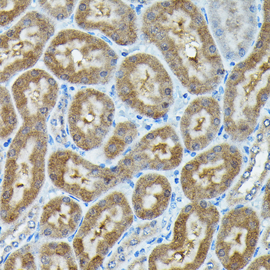 C9orf72 Polyclonal Antibody