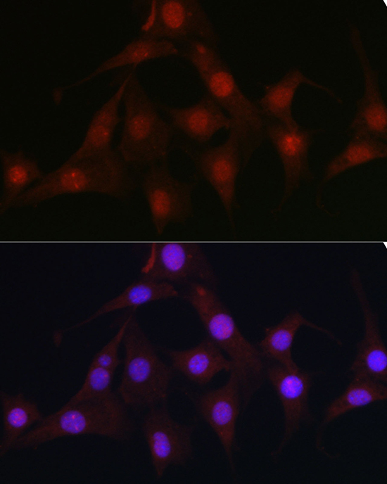 C9orf72 Polyclonal Antibody