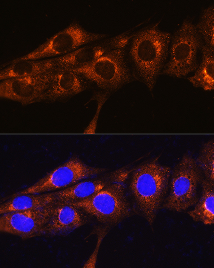 FREM2 Polyclonal Antibody