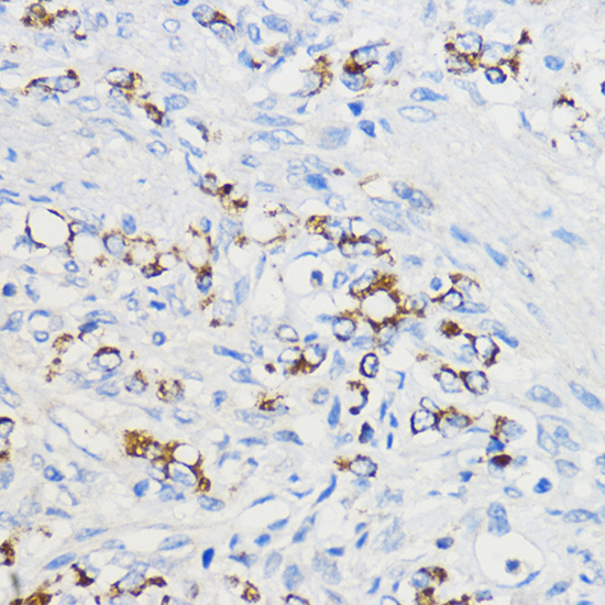 BOLA3 Polyclonal Antibody