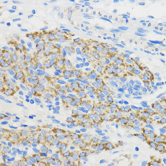 BOLA3 Polyclonal Antibody