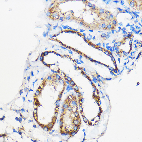 ANT1/ANT2/ANT3/ANT4 Polyclonal Antibody
