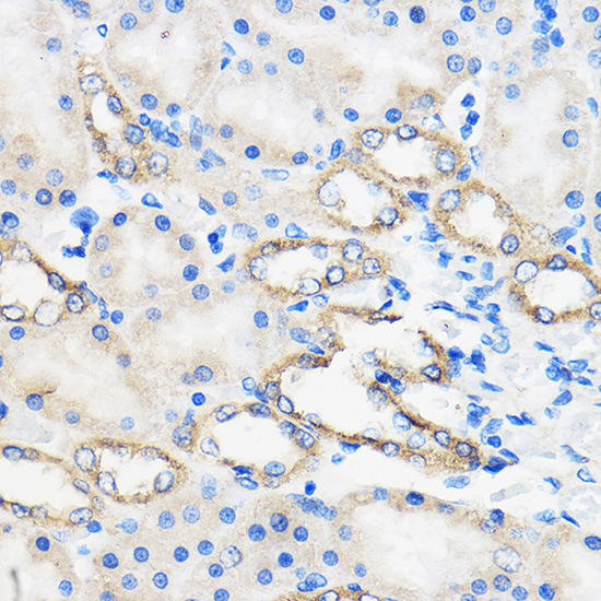ANT1/ANT2/ANT3/ANT4 Polyclonal Antibody