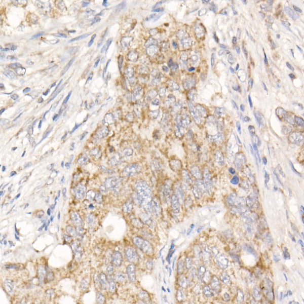 PGAM5 Polyclonal Antibody